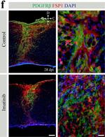 Rabbit IgG (H+L) Highly Cross-Adsorbed Secondary Antibody in Immunohistochemistry (IHC)