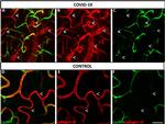 Goat IgG (H+L) Cross-Adsorbed Secondary Antibody in Immunohistochemistry (PFA fixed) (IHC (PFA))