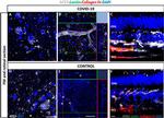 Goat IgG (H+L) Cross-Adsorbed Secondary Antibody in Immunohistochemistry (PFA fixed) (IHC (PFA))