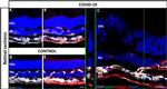 Goat IgG (H+L) Cross-Adsorbed Secondary Antibody in Immunohistochemistry (PFA fixed) (IHC (PFA))