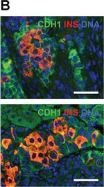 Mouse IgG (H+L) Highly Cross-Adsorbed Secondary Antibody in Immunohistochemistry (Paraffin) (IHC (P))