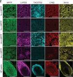 Rabbit IgG (H+L) Highly Cross-Adsorbed Secondary Antibody in Immunohistochemistry (Paraffin) (IHC (P))