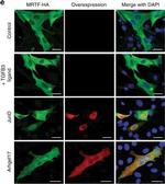 Mouse IgG (H+L) Highly Cross-Adsorbed Secondary Antibody in Immunohistochemistry (Paraffin) (IHC (P))