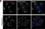 Rabbit IgG (H+L) Highly Cross-Adsorbed Secondary Antibody in Immunocytochemistry (ICC/IF)