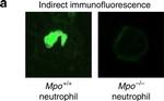 Mouse IgG (H+L) Cross-Adsorbed Secondary Antibody in Immunocytochemistry (ICC/IF)