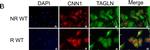 Rabbit IgG (H+L) Highly Cross-Adsorbed Secondary Antibody in Immunocytochemistry (ICC/IF)