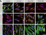 Rabbit IgG (H+L) Highly Cross-Adsorbed Secondary Antibody in Immunocytochemistry (ICC/IF)