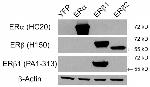 Estrogen Receptor beta Antibody in Western Blot (WB)