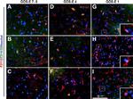 Rabbit IgG (H+L) Highly Cross-Adsorbed Secondary Antibody in Immunohistochemistry (Frozen) (IHC (F))