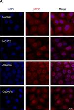 Rabbit IgG (H+L) Highly Cross-Adsorbed Secondary Antibody in Immunocytochemistry (ICC/IF)