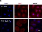 Rabbit IgG (H+L) Highly Cross-Adsorbed Secondary Antibody in Immunocytochemistry (ICC/IF)