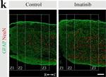 Rabbit IgG (H+L) Highly Cross-Adsorbed Secondary Antibody in Immunohistochemistry (IHC)