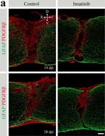 Rat IgG (H+L) Highly Cross-Adsorbed Secondary Antibody in Immunohistochemistry (IHC)