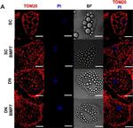 Mouse IgG (H+L) Highly Cross-Adsorbed Secondary Antibody in Immunocytochemistry (ICC/IF)