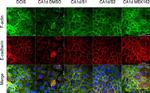 Mouse IgG (H+L) Highly Cross-Adsorbed Secondary Antibody in Immunocytochemistry (ICC/IF)