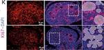 Rabbit IgG (H+L) Highly Cross-Adsorbed Secondary Antibody in Immunohistochemistry (IHC)