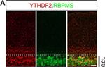 Rabbit IgG (H+L) Highly Cross-Adsorbed Secondary Antibody in Immunohistochemistry (PFA fixed) (IHC (PFA))