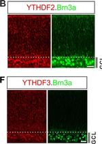 Rabbit IgG (H+L) Highly Cross-Adsorbed Secondary Antibody in Immunohistochemistry (PFA fixed) (IHC (PFA))