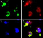 Mouse IgG (H+L) Cross-Adsorbed Secondary Antibody in Immunohistochemistry (IHC)