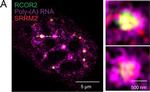 Rabbit IgG (H+L) Secondary Antibody in Immunocytochemistry (ICC/IF)