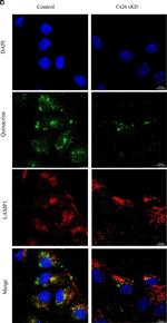 Rabbit IgG (H+L) Secondary Antibody in Immunohistochemistry (Paraffin) (IHC (P))