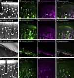 Rabbit IgG (H+L) Highly Cross-Adsorbed Secondary Antibody in Immunohistochemistry (IHC)