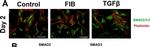 Rabbit IgG (H+L) Highly Cross-Adsorbed Secondary Antibody in Immunocytochemistry (ICC/IF)