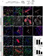 CD324 (E-Cadherin) Antibody in Immunohistochemistry (IHC)