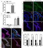 p53 Antibody in Immunohistochemistry (IHC)