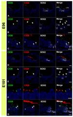 Connexin 26 Antibody in Immunohistochemistry (IHC)