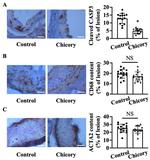 Alpha-Smooth Muscle Actin Antibody in Immunohistochemistry (IHC)