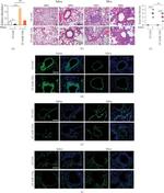 Alpha-Smooth Muscle Actin Antibody in Immunohistochemistry (IHC)