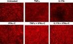 ZO-1 Antibody in Immunocytochemistry (ICC/IF)