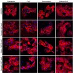 PKP1 Antibody in Immunocytochemistry (ICC/IF)