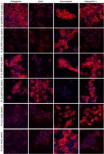 PKP1 Antibody in Immunocytochemistry (ICC/IF)