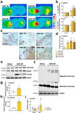 alpha Synuclein Antibody in Western Blot (WB)