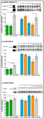 Phospho-ERK1/ERK2 (Thr202, Tyr204) Antibody in Western Blot (WB)