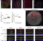 Neurofascin Antibody in Immunocytochemistry (ICC/IF)