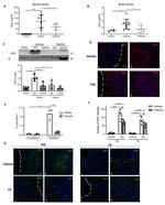 beta Amyloid Antibody in Immunohistochemistry (Frozen) (IHC (F))