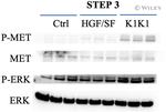 c-Met Antibody in Western Blot (WB)