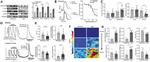 JPH2 Antibody in Western Blot (WB)