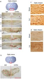 beta Amyloid Antibody in Immunohistochemistry (IHC)