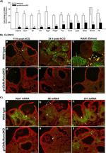 Claudin 18 Antibody in Immunohistochemistry (IHC)