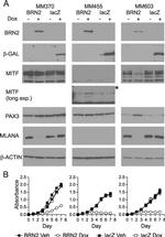 PAX3 Antibody in Western Blot (WB)