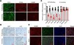 Ki-67 Antibody in Immunohistochemistry (IHC)