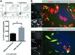 alpha Actinin 1 Antibody in Immunocytochemistry (ICC/IF)