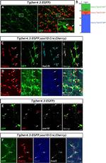 HuC/HuD Antibody in Immunohistochemistry (IHC)