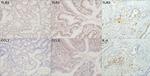 IL-8 (CXCL8) Antibody in Immunohistochemistry (IHC)