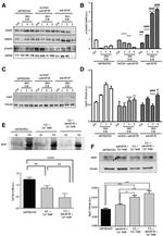 Phospho-CaMKII alpha (Thr286) Antibody in Western Blot (WB)