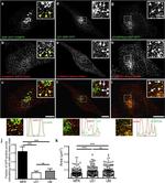 Clathrin Heavy Chain Antibody in Immunocytochemistry (ICC/IF)